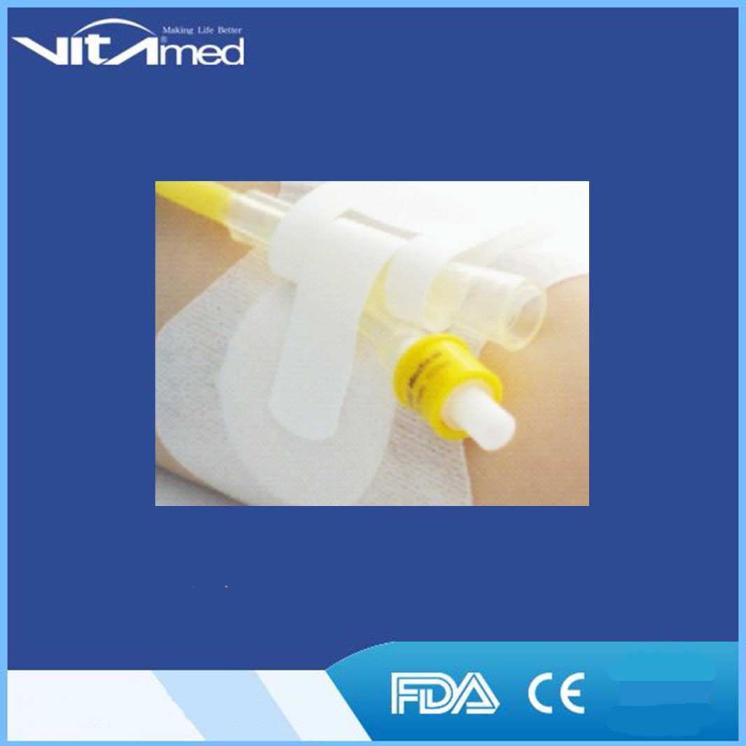 Catheter Fixation Device